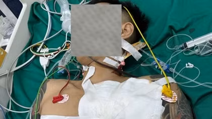 Mâu thuẫn bán hàng, chủ quán cà phê cầm dao chém "đối thủ"