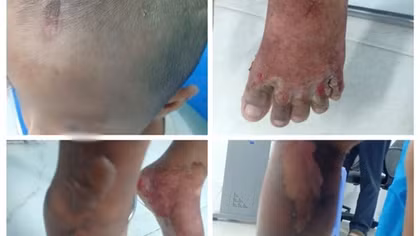 Truy tìm cha của bé trai 6 tuổi nghi bị bạo hành để làm rõ vụ việc