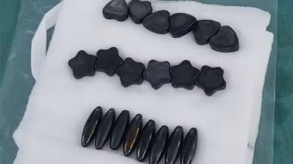 Bé trai 10 tuổi nuốt 20 viên nam châm vì nghĩ là kẹo