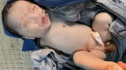 Bé trai sơ sinh nặng 3kg bị bỏ rơi