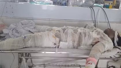 Năm người thương vong từ vụ chủ nhà dùng xăng đốt phòng ngủ