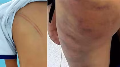 Khởi tố mẹ kế đánh con chồng