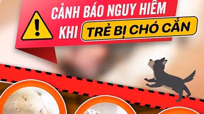 Bé gái bị 4 con chó tấn công với hàng trăm vết thương trên người