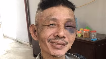 "Ngáo đá" liên tục chửi bới, đe dọa các nhà hàng xóm