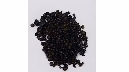 Hơn 400 viên sỏi trong túi mật của người phụ nữ 44 tuổi