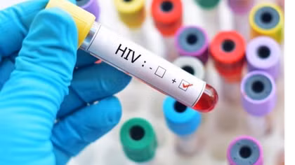 Điều kiện xác định người bị phơi nhiễm, nhiễm HIV do tai nạn rủi ro nghề nghiệp