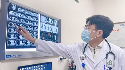Cảnh báo đột tử khi liên tiếp có người bị lóc động mạch chủ cấp cứu