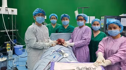 Khối u 1,5kg “cố thủ” hơn 10 năm trong cổ nữ bệnh nhân