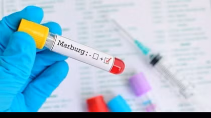 Giám sát chặt nguy cơ lây lan virus Marburg vào Việt Nam