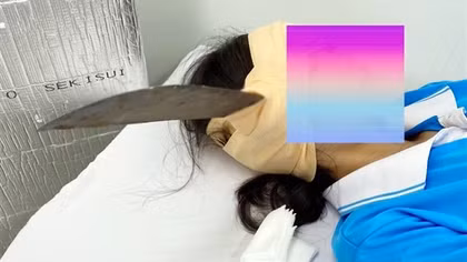 Nữ sinh đang ngồi uống nước, bất ngờ lưỡi dao găm vào đầu
