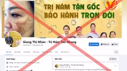 “Giang Thị Nhàn – trị nám tàn nhang” là lương y ảo