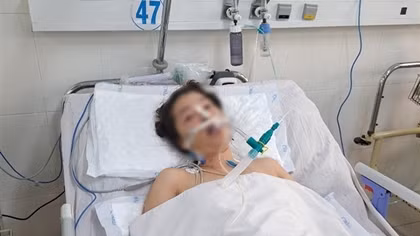 Hạ thân nhiệt chủ động, cứu sống bệnh nhân ngưng tim