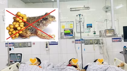 3 mẹ con ngộ độc sau khi ăn thịt và trứng cóc