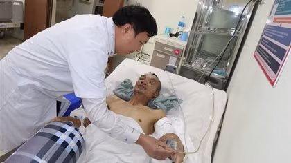 Đứt lìa cánh tay sau khi rơi từ giàn giáo cao hơn 8m