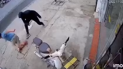 Truy tố kẻ gây ra vụ chém gãy chân người đàn ông đi bộ trên đường