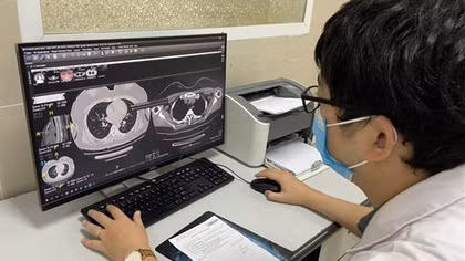 Hậu COVID-19 có 203 triệu chứng, tránh lạm dụng chỉ định không cần thiết