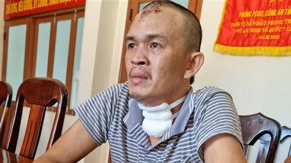 Khởi tố kẻ dùng búa, dao sát hại vợ vì ghen