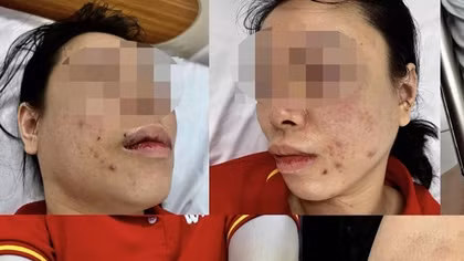 Điều tra đơn của người phụ nữ tố cáo bị chồng cũ bạo hành