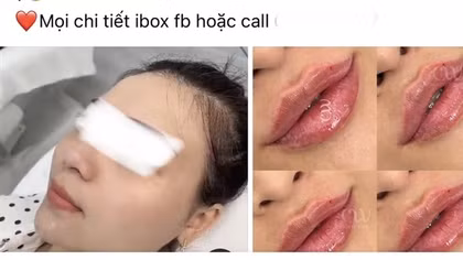 Làm đẹp trên mạng – Coi chừng tiền mất, tật mang