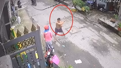 Mâu thuẫn từ việc thả chó, một phụ nữ bị đánh bầm tím người
