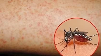 Đồng Tháp có 8.425 ca mắc sốt xuất huyết