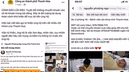 Giả mạo hình ảnh thương tâm của cháu bé để lừa đảo từ thiện