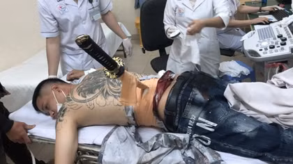 Nhờ người tình bẫy "đối thủ" đến rồi dùng kiếm Nhật đâm
