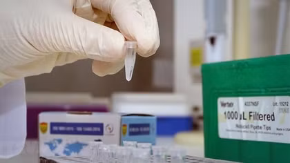 Bộ Y tế lí giải nguyên nhân giá kit test tăng
