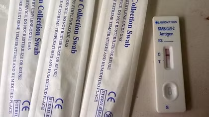 Phát hiện vụ chia lẻ gói thầu mua sắm kit test COVID-19 để chỉ định thầu rút gọn