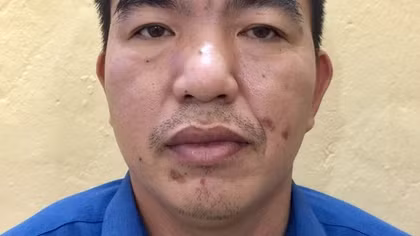 Mạo danh là Công an, lừa nhận tiền của gia đình bệnh nhân "chạy" mổ sớm