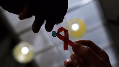 Người phụ nữ đầu tiên trên thế giới được chữa khỏi HIV nhờ cấy ghép tế bào