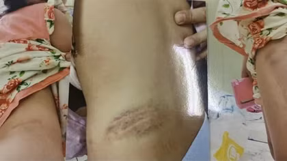 Đừng bắt những đứa trẻ phải tự chống đỡ