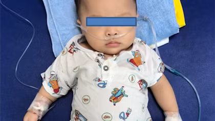 Vì nhiễm COVID-19, bệnh nhi mắc bệnh hiếm gặp của thế giới