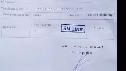 Khởi tố hai đối tượng mua bán 130 giấy xét nghiệm COVID-19