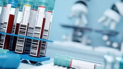Nga cảnh báo một virus nguy hiểm lây lan mùa Thu tới
