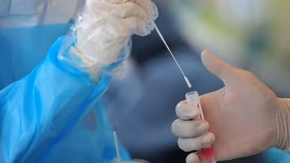 Hà Lan bắt nghi phạm mua bán virus SARS-CoV-2 qua bưu điện