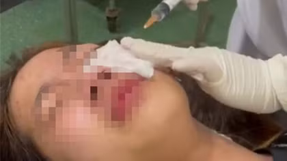 Điều tra nhóm thanh niên xịt hơi cay vào mặt nữ sinh