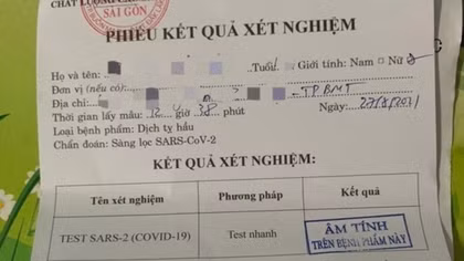 Người vào Tây Ninh không cần giấy xét nghiệm SARS-CoV-2