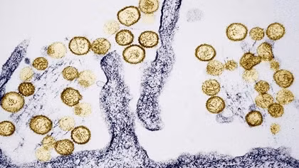 Ổ dịch virus Hanta trên tàu du lịch Đại Tây Dương tăng lên 8 ca, WHO đang truy vết