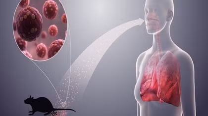 Bộ Y tế cảnh báo khẩn về loại virus lây từ chuột sau chùm ca bệnh tử vong trên tàu du lịch