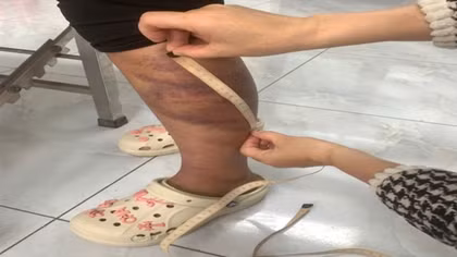 Tạm giữ người đàn ông nhiều lần bạo hành vợ đang mang thai và con gái 13 tuổi