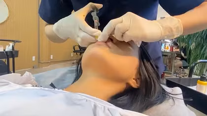 Một cơ sở “thẩm mỹ chui” tiêm filler gây biến chứng