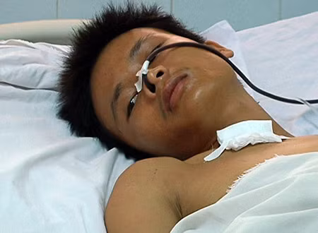 Đối tượng Nguyễn Thanh Hiệp đang được điều trị tại Bệnh viện 175.