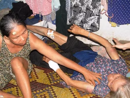 Những vết thương của ba người phụ nữ do kẻ côn đô hành hung.