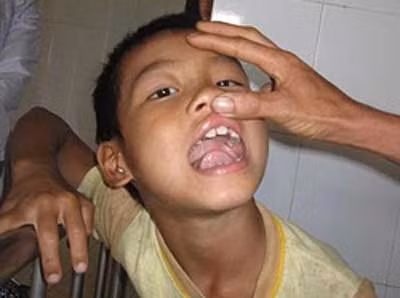 Cháu Trần Ngọc Lễ không bị đánh đập dã man như một số từ báo đưa tin.