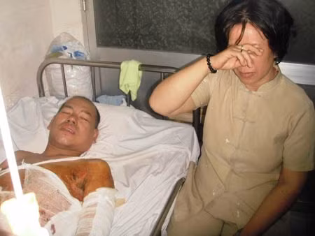 Đã lướt qua lưỡi hái của tử thần, mẹ con bác sĩ Tú sẽ còn trải qua "trận đánh" cuối - ngày người mẹ kiên cường hiến thận cho con .