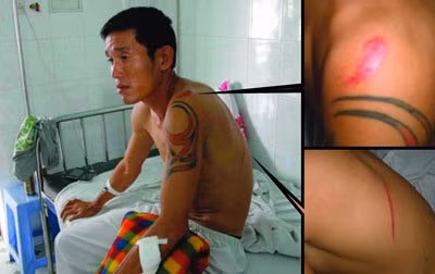 Trần Chí Công tại bệnh viện.