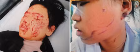 Gia Hân và Quỳnh Anh.