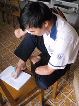 Cậu học trò không “đầu hàng” với số phận ảnh 2