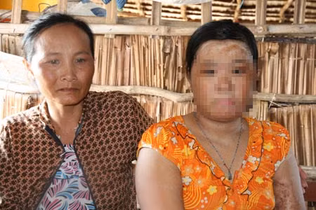 Bé Hiệp và giọt nước mắt lăn dài của mẹ.